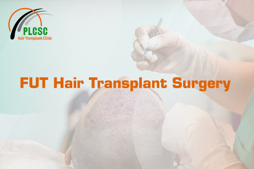 FUT Hair Transplant Surgery 1