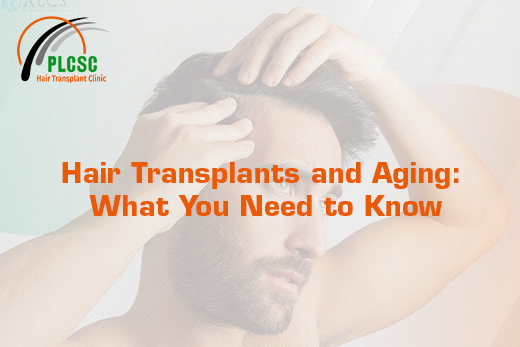 Hair Transplants and Aging What You Need to Know