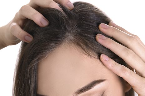 Tips to Speed Hair Growth After Hair Transplant Surgery