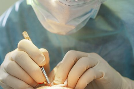 Tips to choose the best surgeon